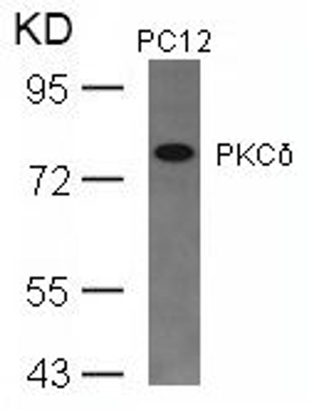 Western blot analysis of lysed extracts from PC12 cells using PKC&#948; (Ab-645).