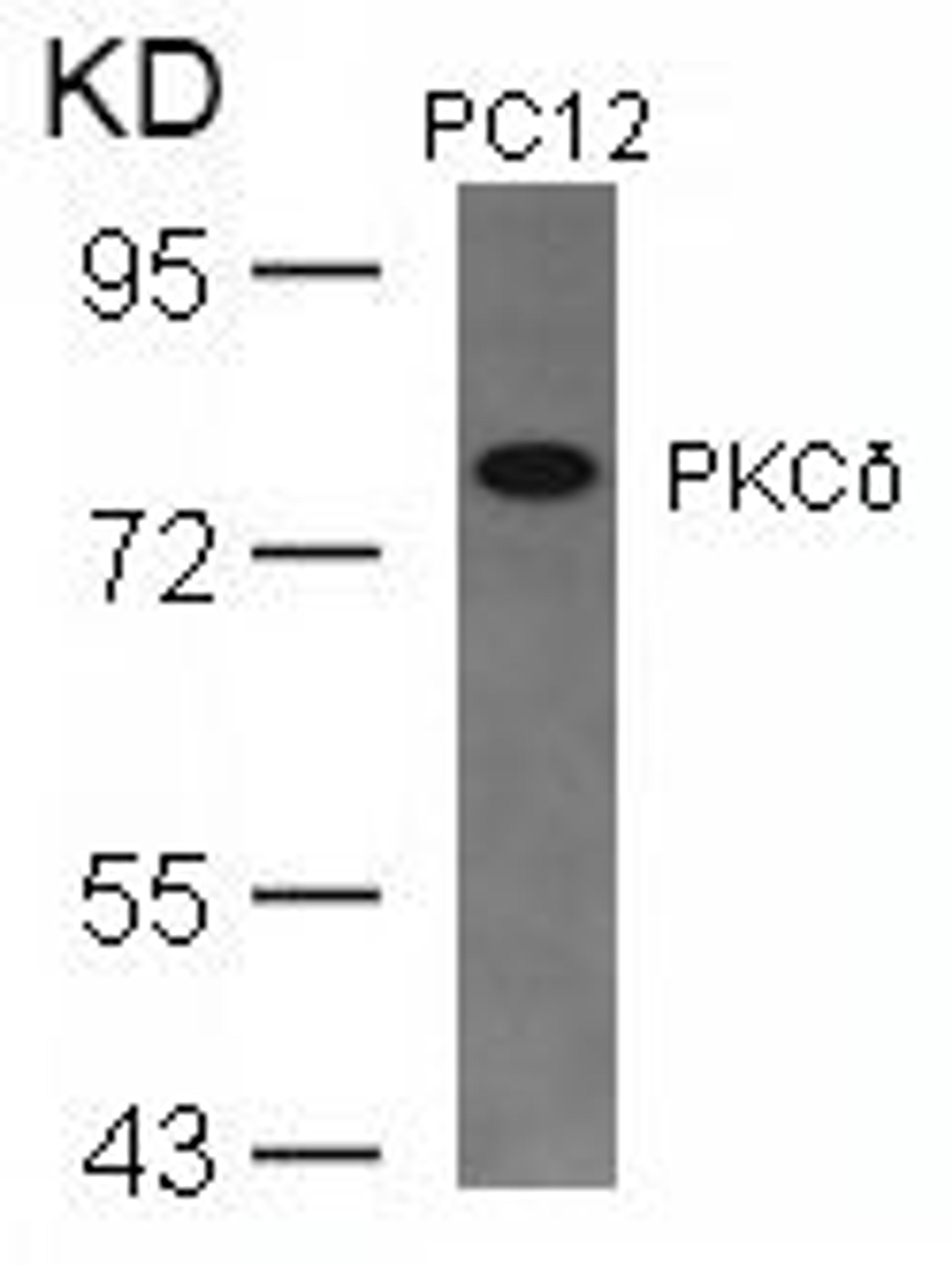 Western blot analysis of lysed extracts from PC12 cells using PKC&#948; (Ab-645).