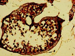 Immunohistochemistry of paraffin-embedded human testis tissue using CSB-PA855052LA01HU at dilution of 1:100