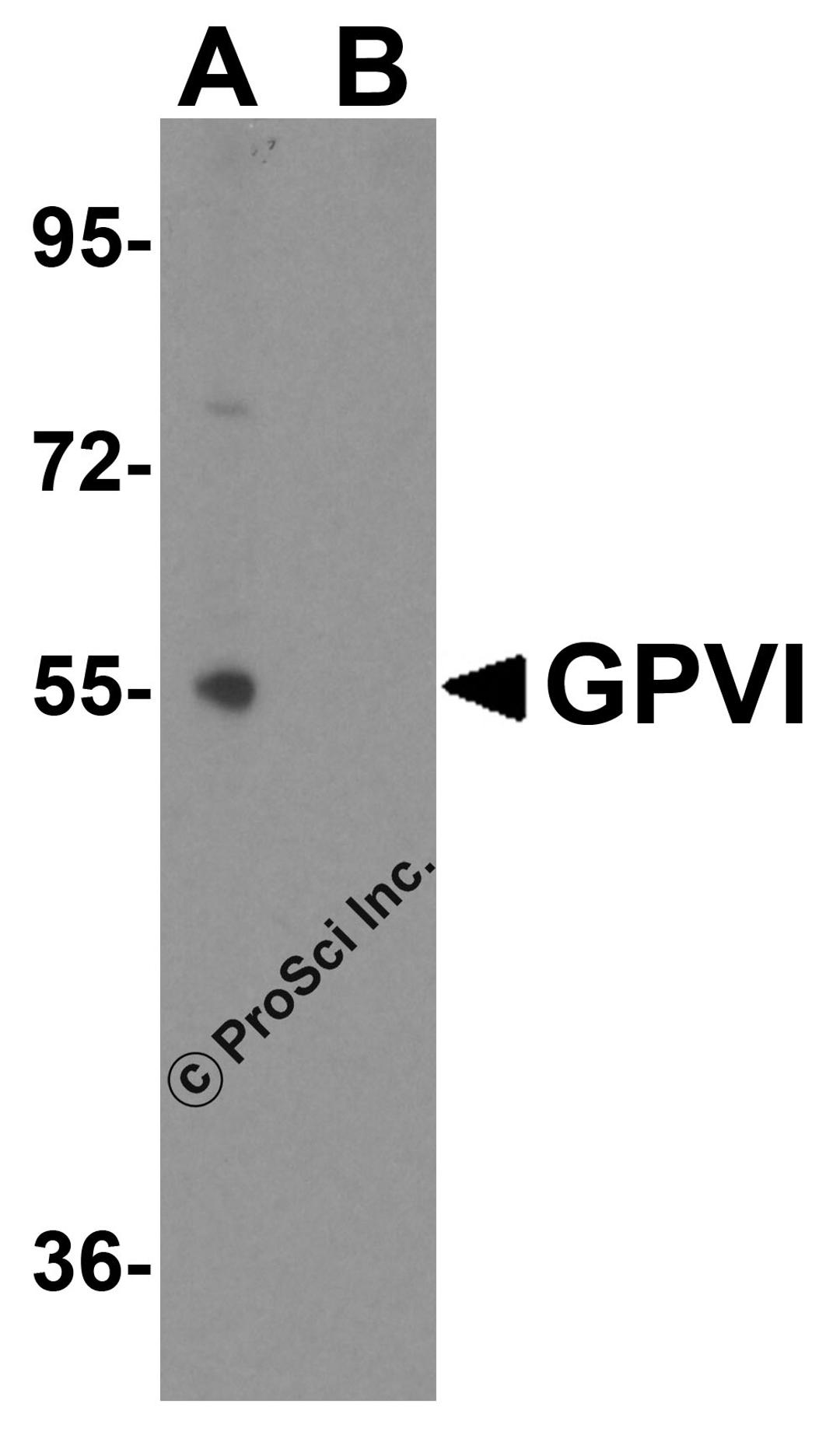 Western blot analysis of GPVI expression in Jurkat cell lysate with GPVI antibody at 1 μg/ml in (A) the absence and (B) the presence of blocking peptide.