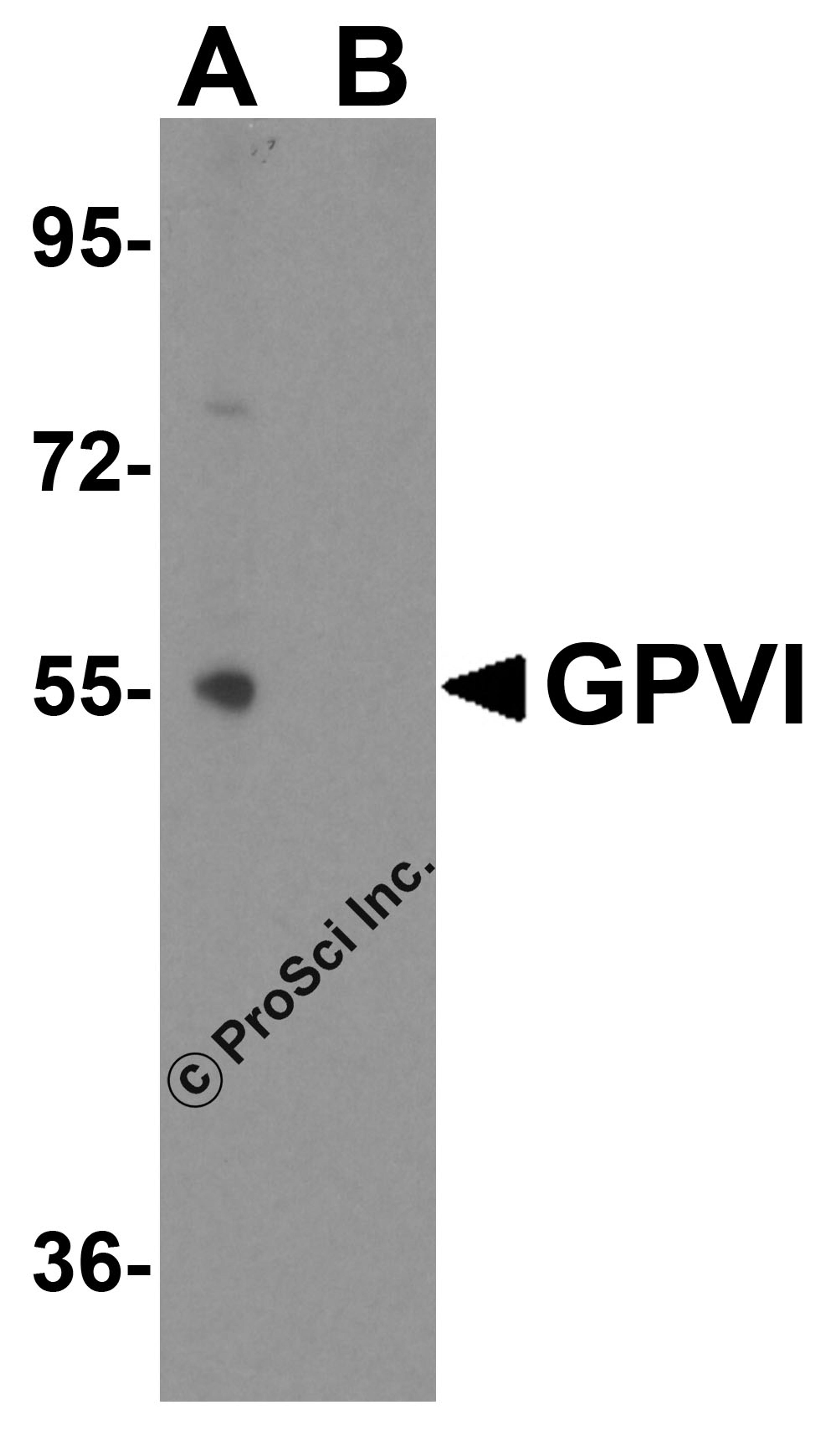 Western blot analysis of GPVI expression in Jurkat cell lysate with GPVI antibody at 1 μg/ml in (A) the absence and (B) the presence of blocking peptide.