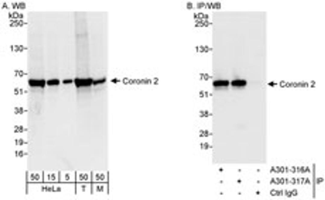 Detection of human and mouse Coronin 2 by western blot (h&m) and immunoprecipitation (h).