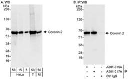 Detection of human and mouse Coronin 2 by western blot (h&m) and immunoprecipitation (h).