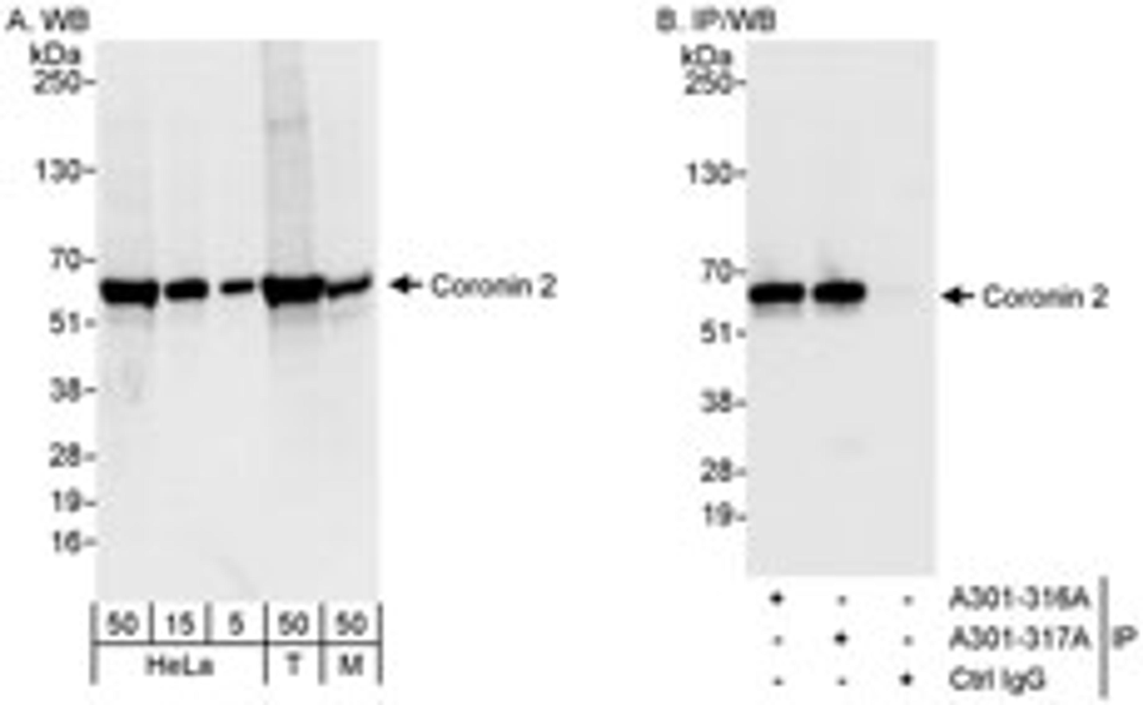 Detection of human and mouse Coronin 2 by western blot (h&m) and immunoprecipitation (h).