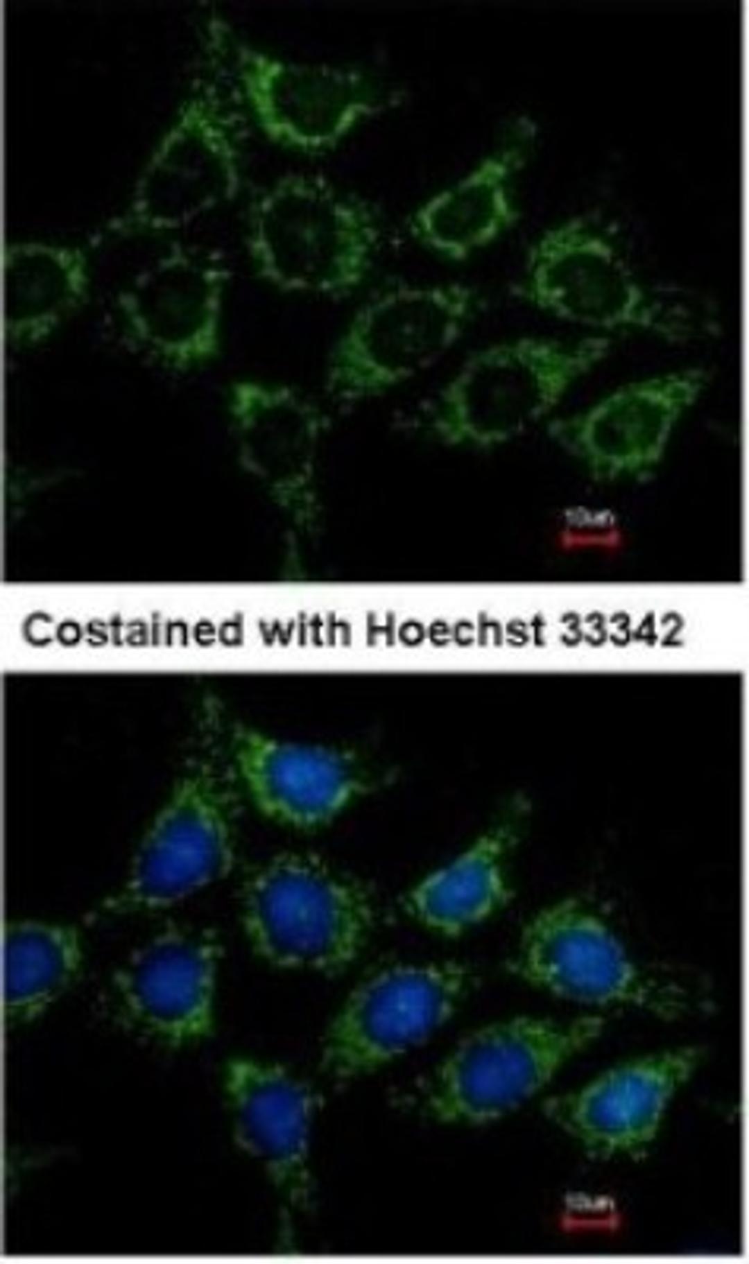 Immunocytochemistry/Immunofluorescence: Acylglycerol Kinase Antibody [NBP1-32163] - Methanol-fixed Hep3B, using Acylglycerol kinase (NBP1-32163) antibody at 1:500 dilution.