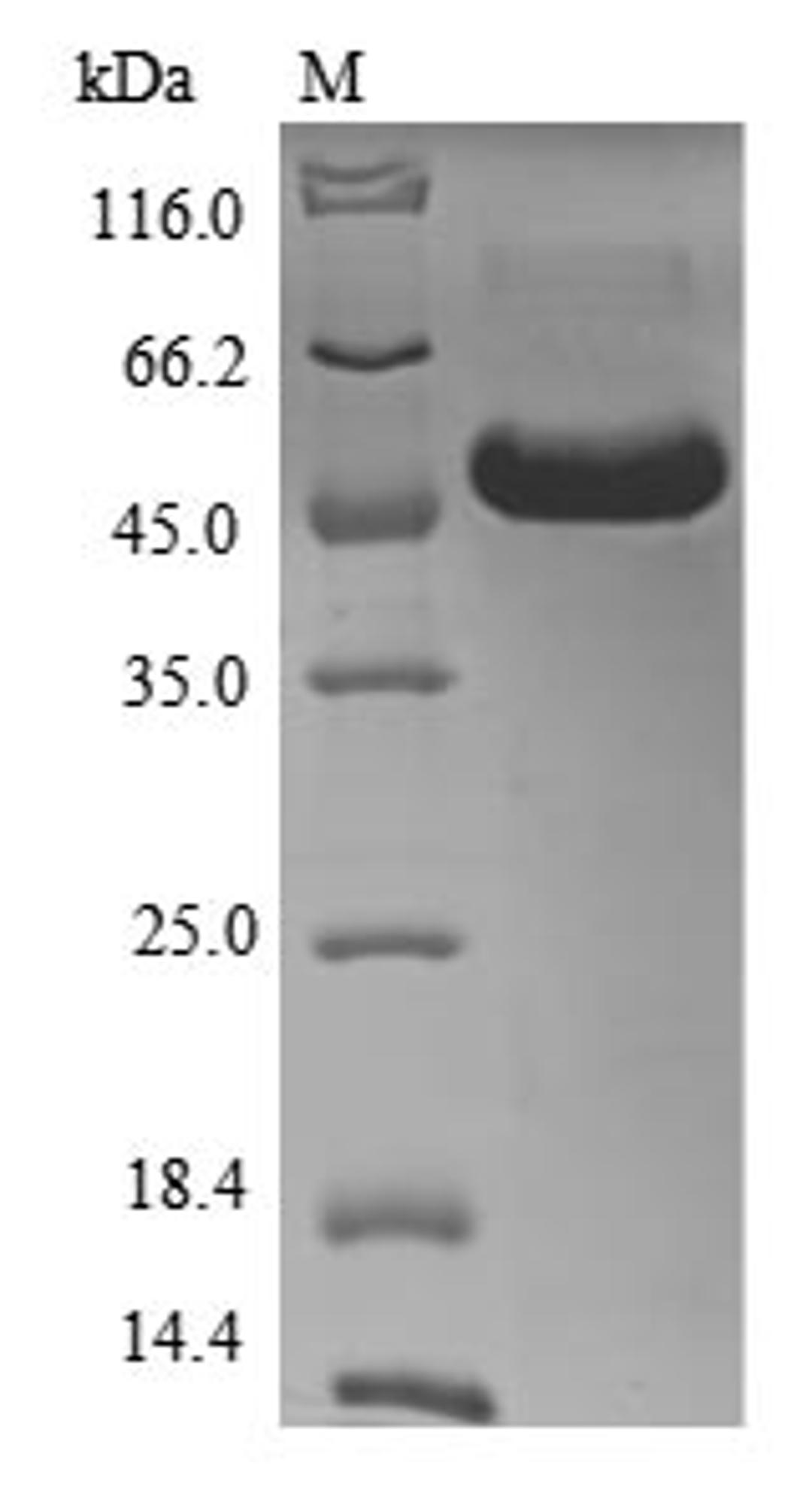 (Tris-Glycine gel) Discontinuous SDS-PAGE (reduced) with 5% enrichment gel and 15% separation gel.