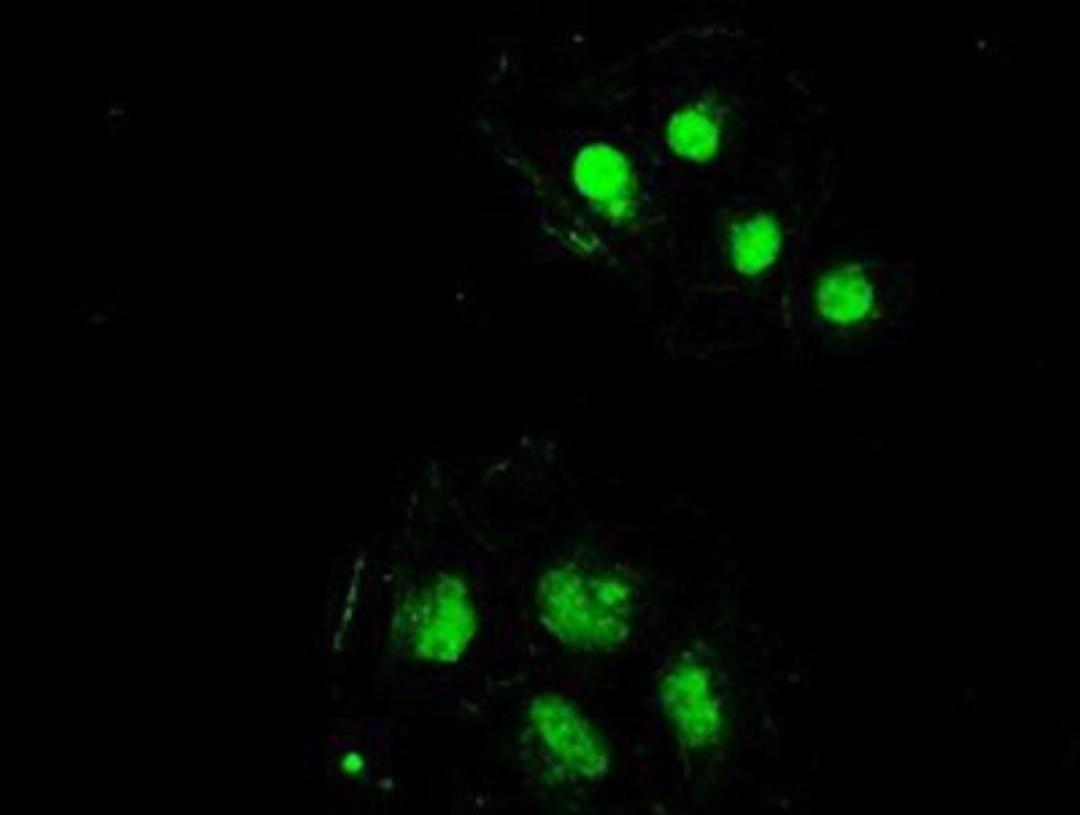 Immunocytochemistry/Immunofluorescence: SSB Antibody (2C8) [NBP1-48002] - Staining of COS7 cells transiently transfected by pCMV6-ENTRY SSB.