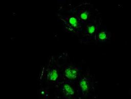 Immunocytochemistry/Immunofluorescence: SSB Antibody (2C8) [NBP1-48002] - Staining of COS7 cells transiently transfected by pCMV6-ENTRY SSB.