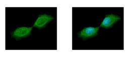 Immunocytochemistry/Immunofluorescence: Septin-12 Antibody [NBP2-20300] - Sample: A431 cells were fixed in iced-cold MeOH for 5 min. Green: SEPT12 protein stained by SEPT12 antibody diluted at 1:500. Blue: Hoechst 33342 staining.