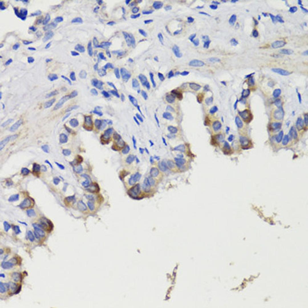 Immunohistochemistry  - DEPDC6 antibody (A17305)