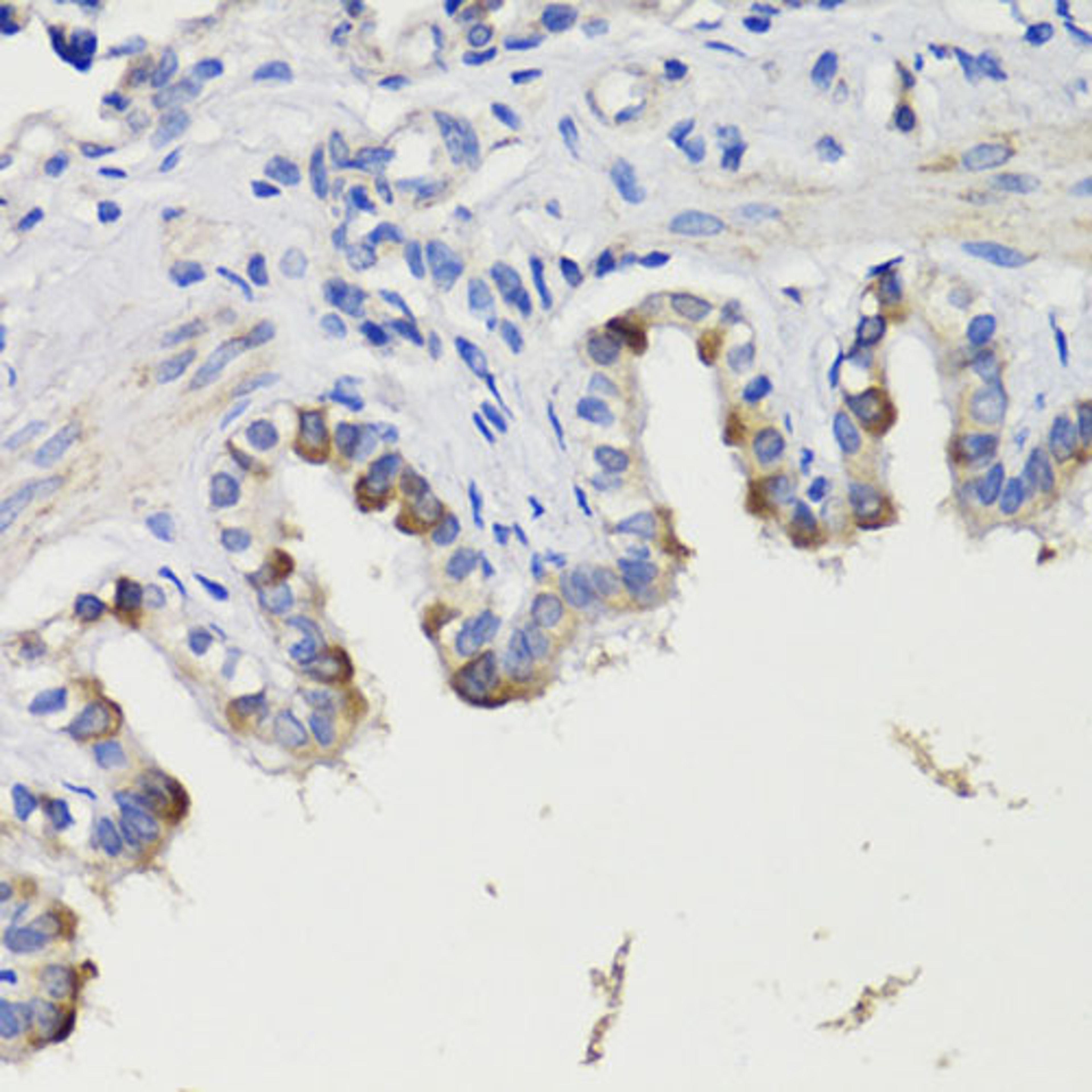 Immunohistochemistry  - DEPDC6 antibody (A17305)