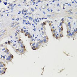 Immunohistochemistry - DEPDC6 antibody (A17305)