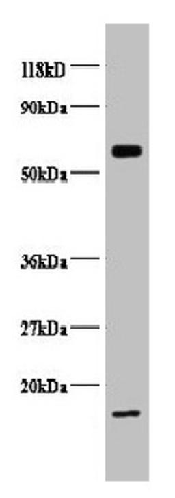 Western blot. All lanes: COX5B antibody at 2µg/ml + EC109 whole cell lysate. Secondary. Goat polyclonal to rabbit IgG at 1/15000 dilution. Predicted band size: 14 kDa. Observed band size: 14, 65 kDa