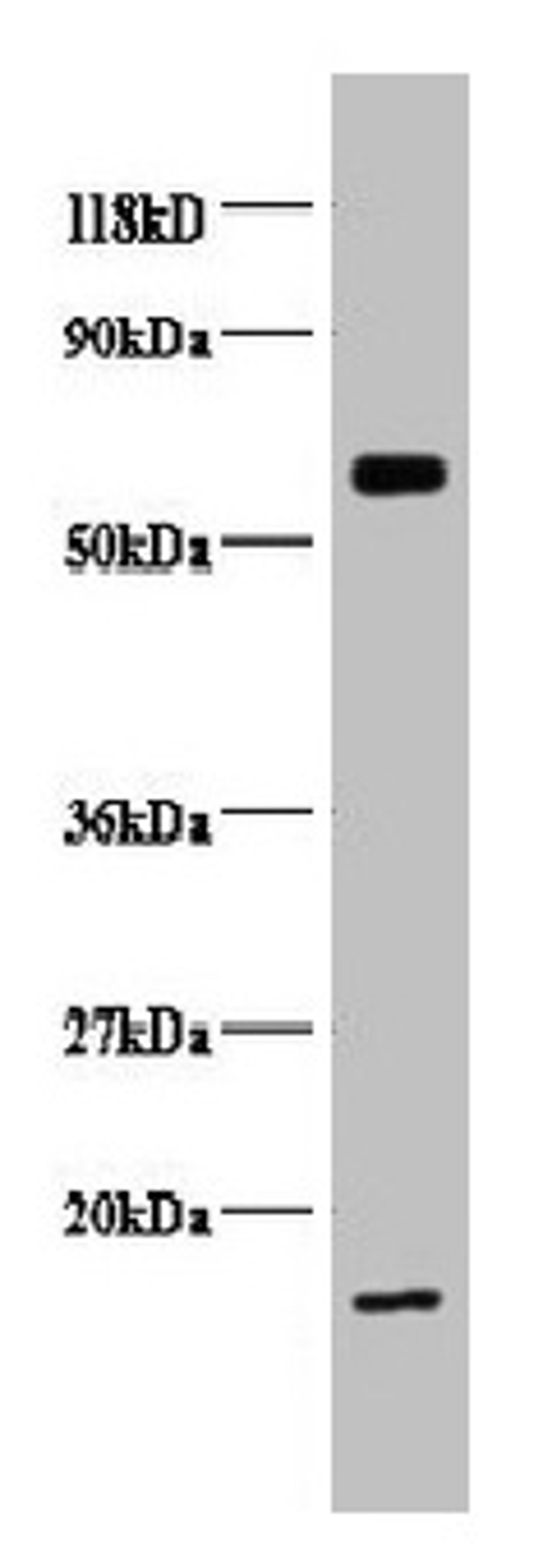 Western blot. All lanes: COX5B antibody at 2µg/ml + EC109 whole cell lysate. Secondary. Goat polyclonal to rabbit IgG at 1/15000 dilution. Predicted band size: 14 kDa. Observed band size: 14, 65 kDa