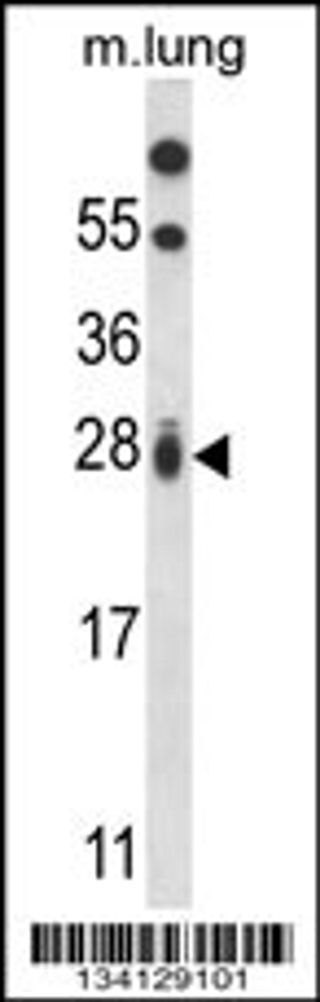 Western blot analysis in mouse lung tissue lysates (35ug/lane).