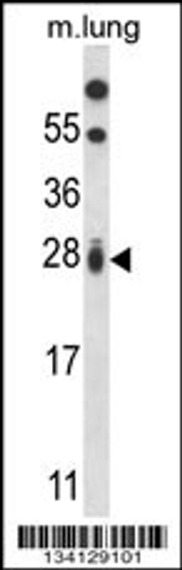 Western blot analysis in mouse lung tissue lysates (35ug/lane).