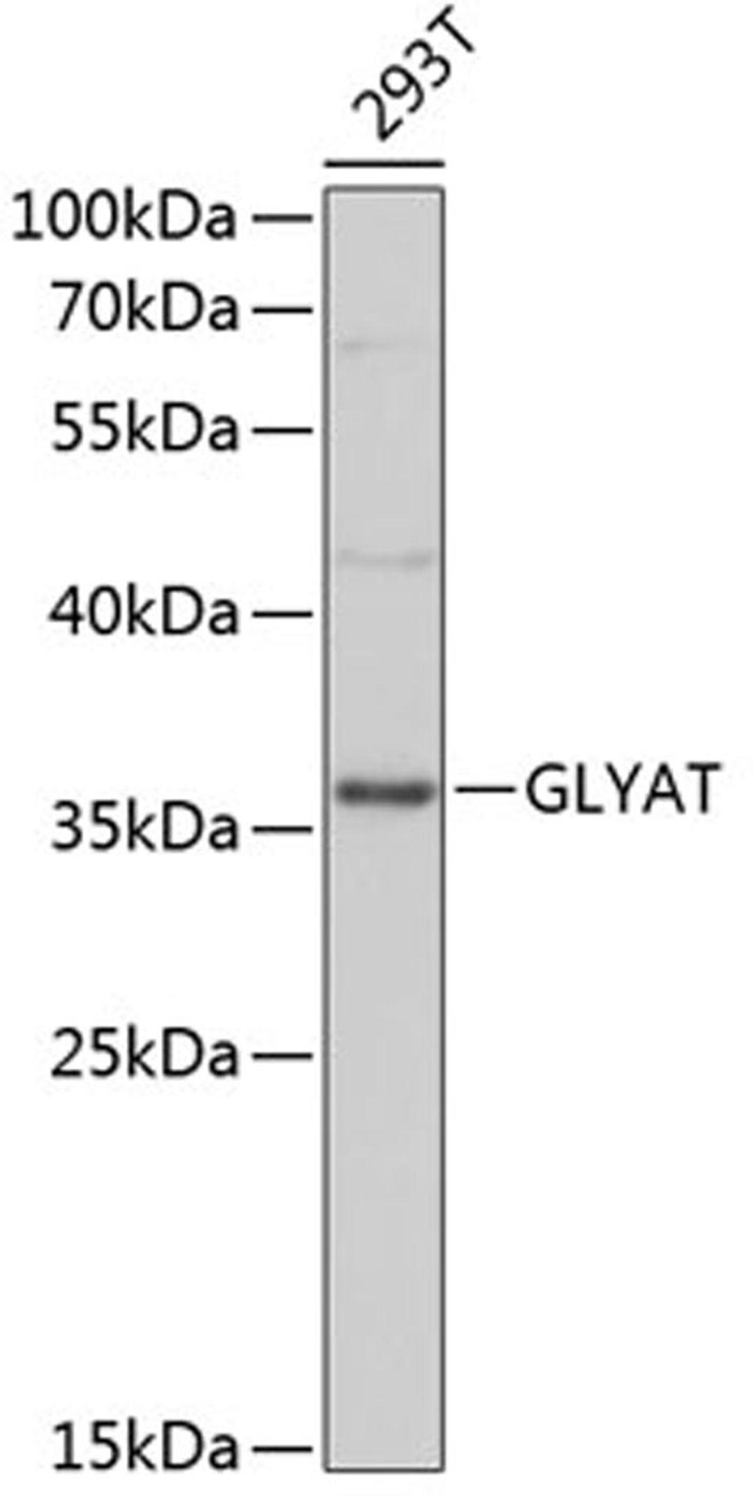 Western blot - GLYAT antibody (A13831)