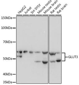 Western blot - GLUT3 Rabbit mAb (A4137)