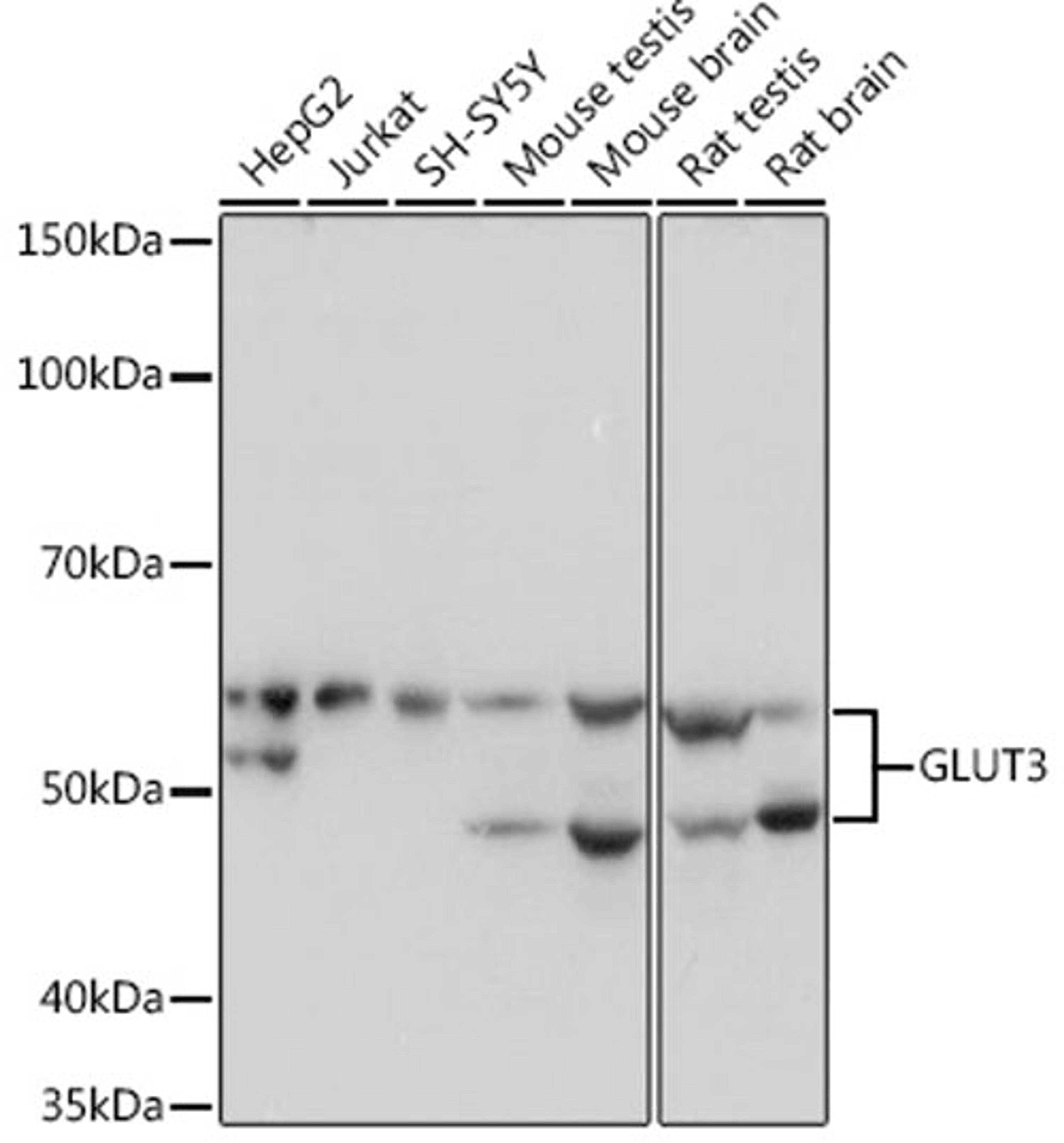 Western blot - GLUT3 Rabbit mAb (A4137)