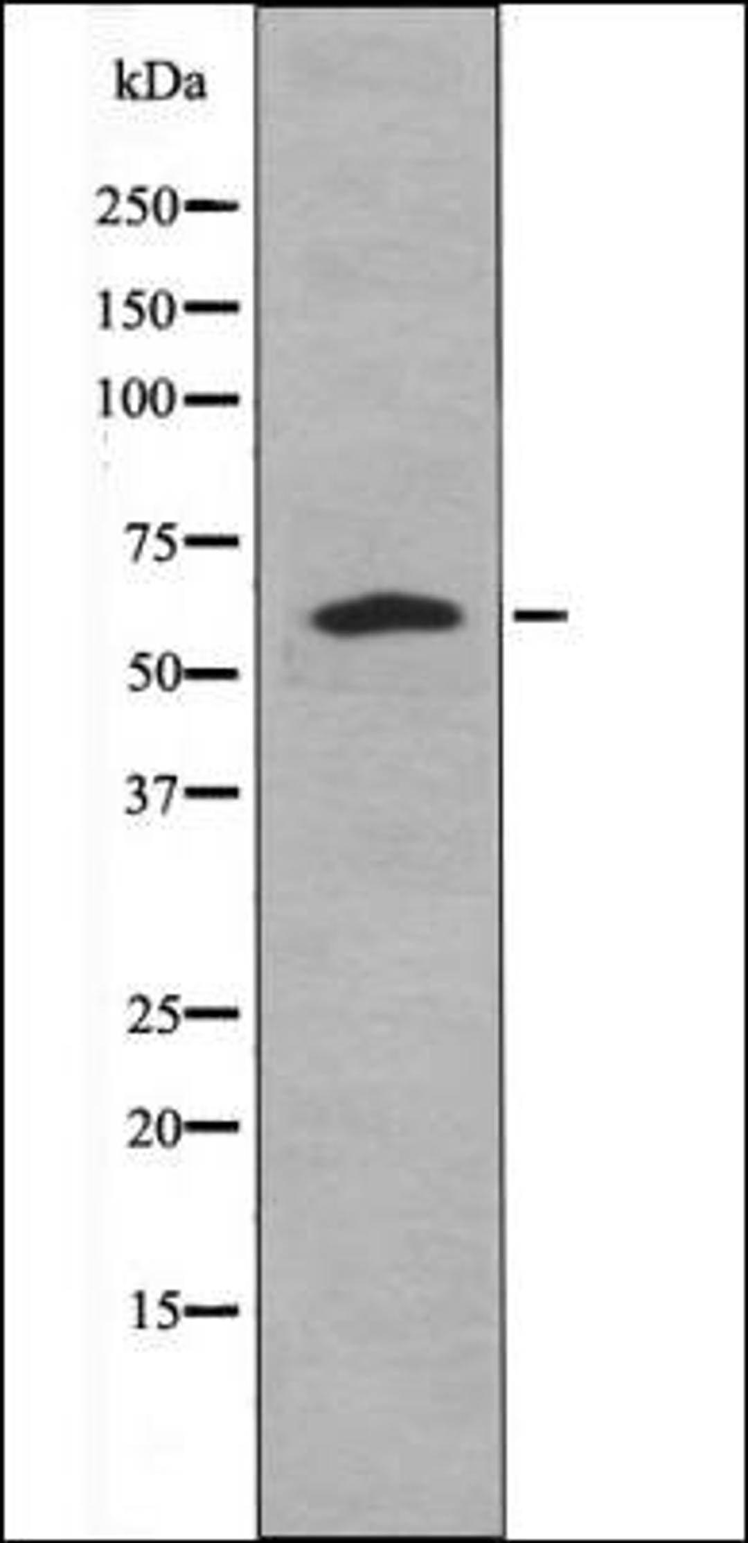 Western blot analysis of forskolin treated HeLa whole cell lysates using Caspase 8 -Phospho-Tyr448- antibody