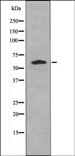 Western blot analysis of forskolin treated HeLa whole cell lysates using Caspase 8 -Phospho-Tyr448- antibody