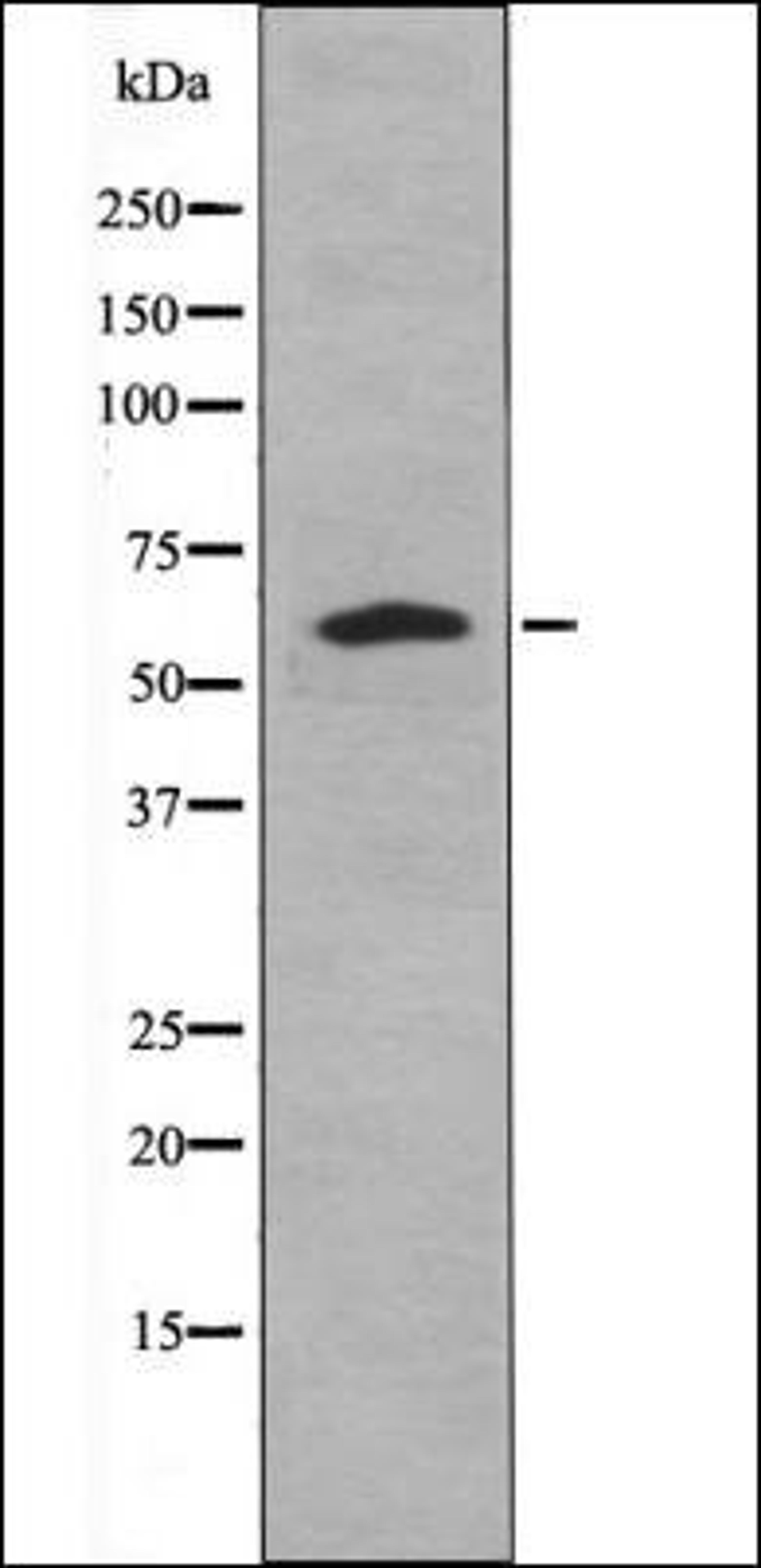 Western blot analysis of forskolin treated HeLa whole cell lysates using Caspase 8 -Phospho-Tyr448- antibody