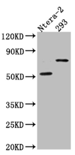 Western Blot. Positive WB detected in: Ntera-2 whole cell lysate, HEK293 whole cell lysate. All lanes: GABA A Receptor alpha 5 antibody at 1:1000. Secondary. Goat polyclonal to rabbit IgG at 1/50000 dilution. Predicted band size: 53 kDa. Observed band size: 70 kDa.