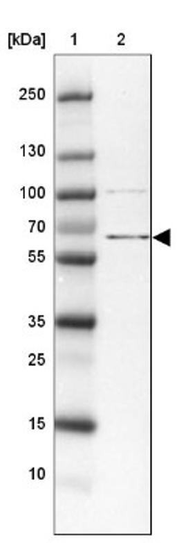 Western Blot: ZBED5 Antibody [NBP2-13533] - Lane 1: Marker [kDa] 250, 130, 100, 70, 55, 35, 25, 15, 10<br/>Lane 2: Tonsil