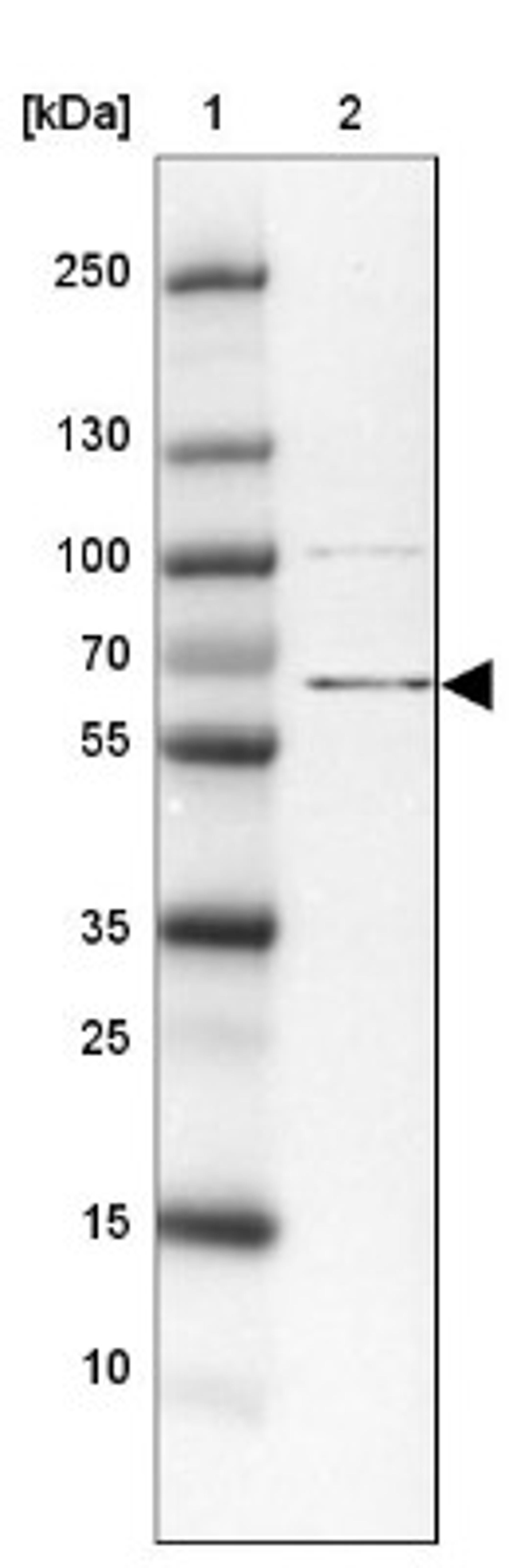 Western Blot: ZBED5 Antibody [NBP2-13533] - Lane 1: Marker [kDa] 250, 130, 100, 70, 55, 35, 25, 15, 10<br/>Lane 2: Tonsil