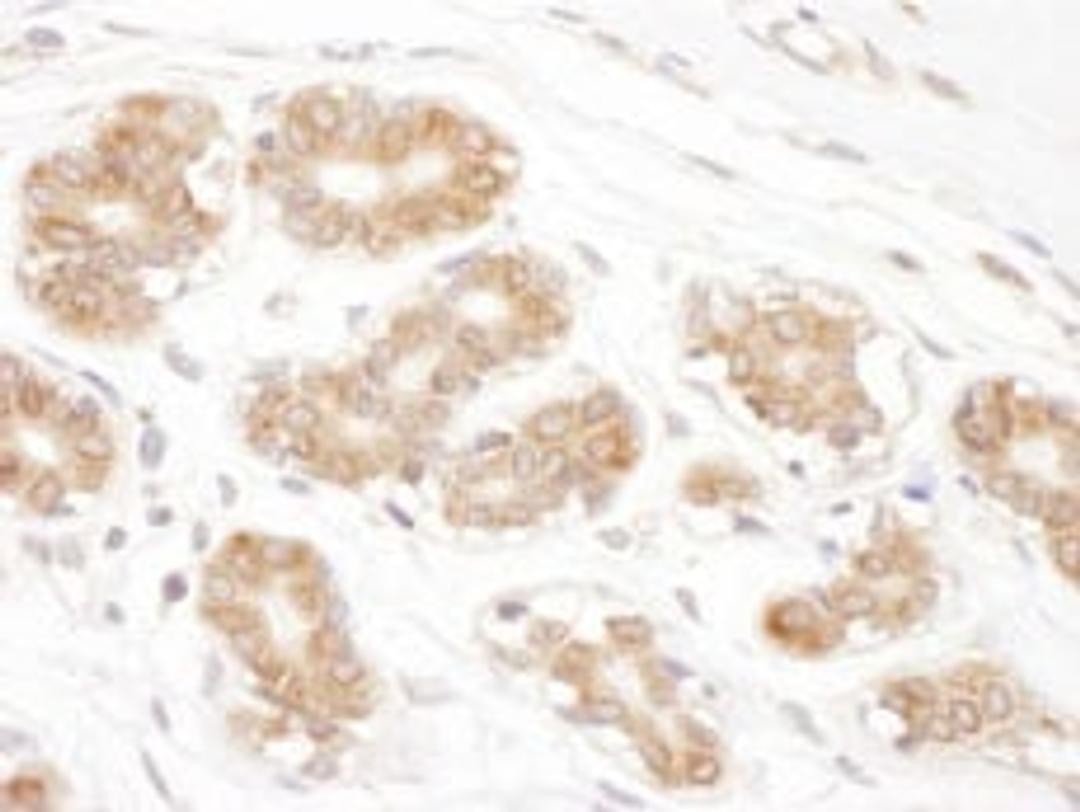 Detection of human RPN2 by immunohistochemistry.