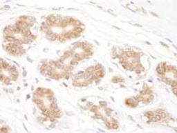 Detection of human RPN2 by immunohistochemistry.