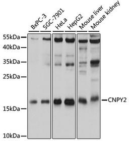 Western blot - CNPY2 antibody (A12197)