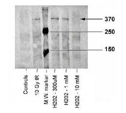 Western Blot: ATM [p Ser1981] Antibody (10H11.E12) [NB100-306] - Analysis of ATM-kinase, using NB100-306. Sample: Irradiated or peroxidated human fibroblasts.