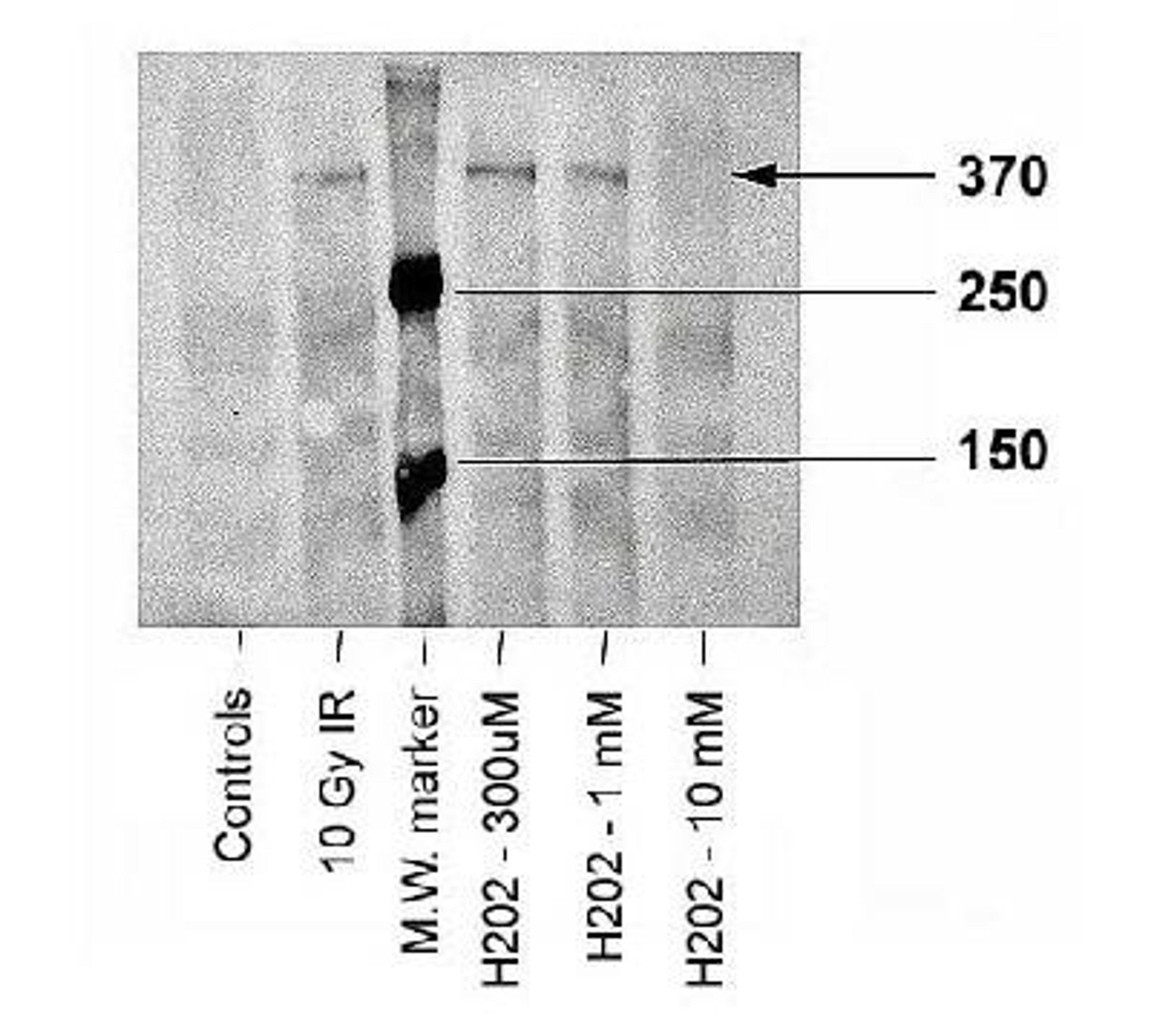 Western Blot: ATM [p Ser1981] Antibody (10H11.E12) [NB100-306] - Analysis of ATM-kinase, using NB100-306. Sample: Irradiated or peroxidated human fibroblasts.