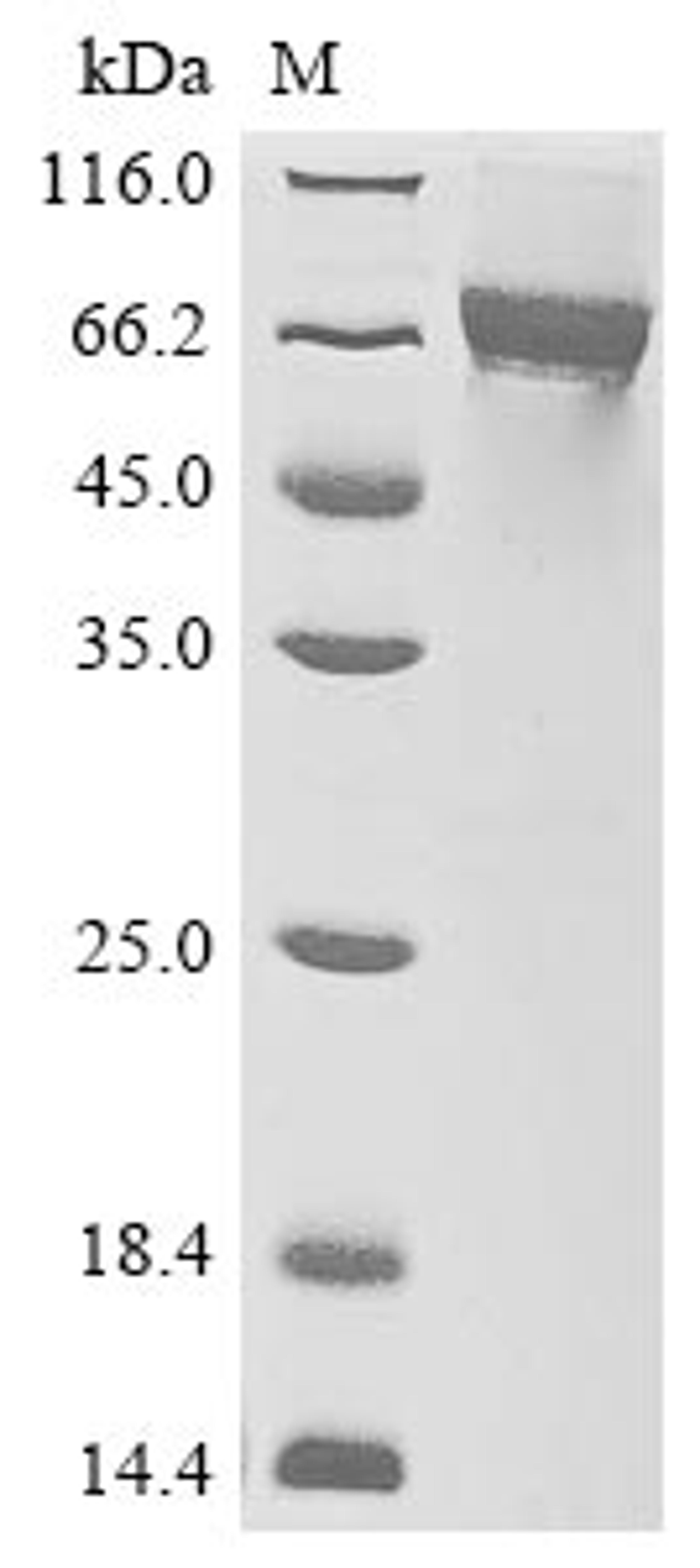 (Tris-Glycine gel) Discontinuous SDS-PAGE (reduced) with 5% enrichment gel and 15% separation gel.