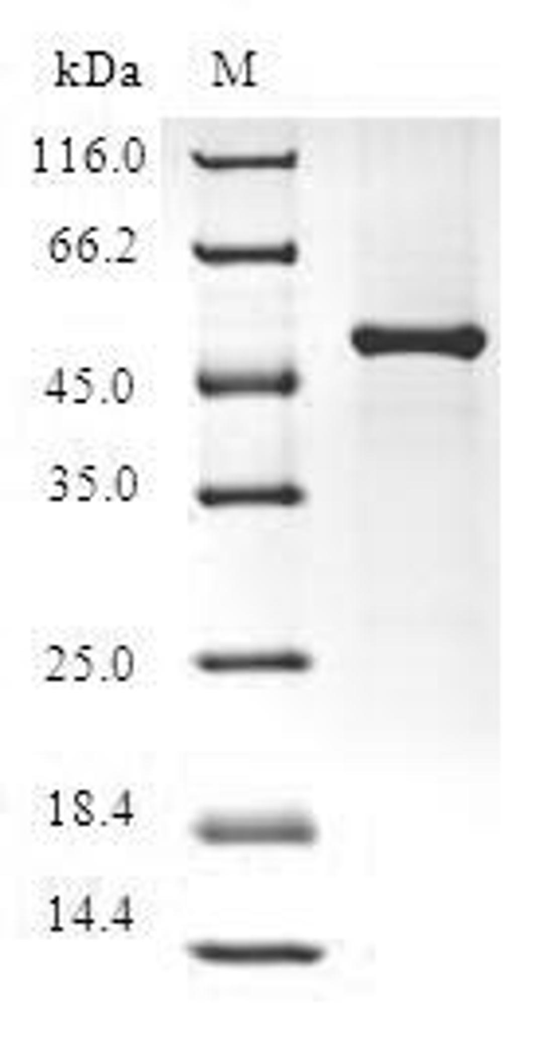 (Tris-Glycine gel) Discontinuous SDS-PAGE (reduced) with 5% enrichment gel and 15% separation gel.