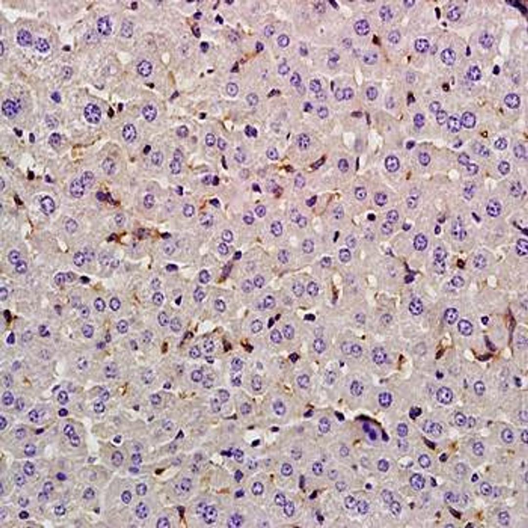 Immunohistochemical analysis of formalin-fixed and paraffin embedded rat liver tissue (dilution at:1:200) using Lysozyme antibody