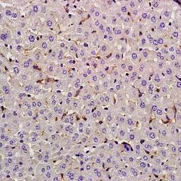 Immunohistochemical analysis of formalin-fixed and paraffin embedded rat liver tissue (dilution at:1:200) using Lysozyme antibody