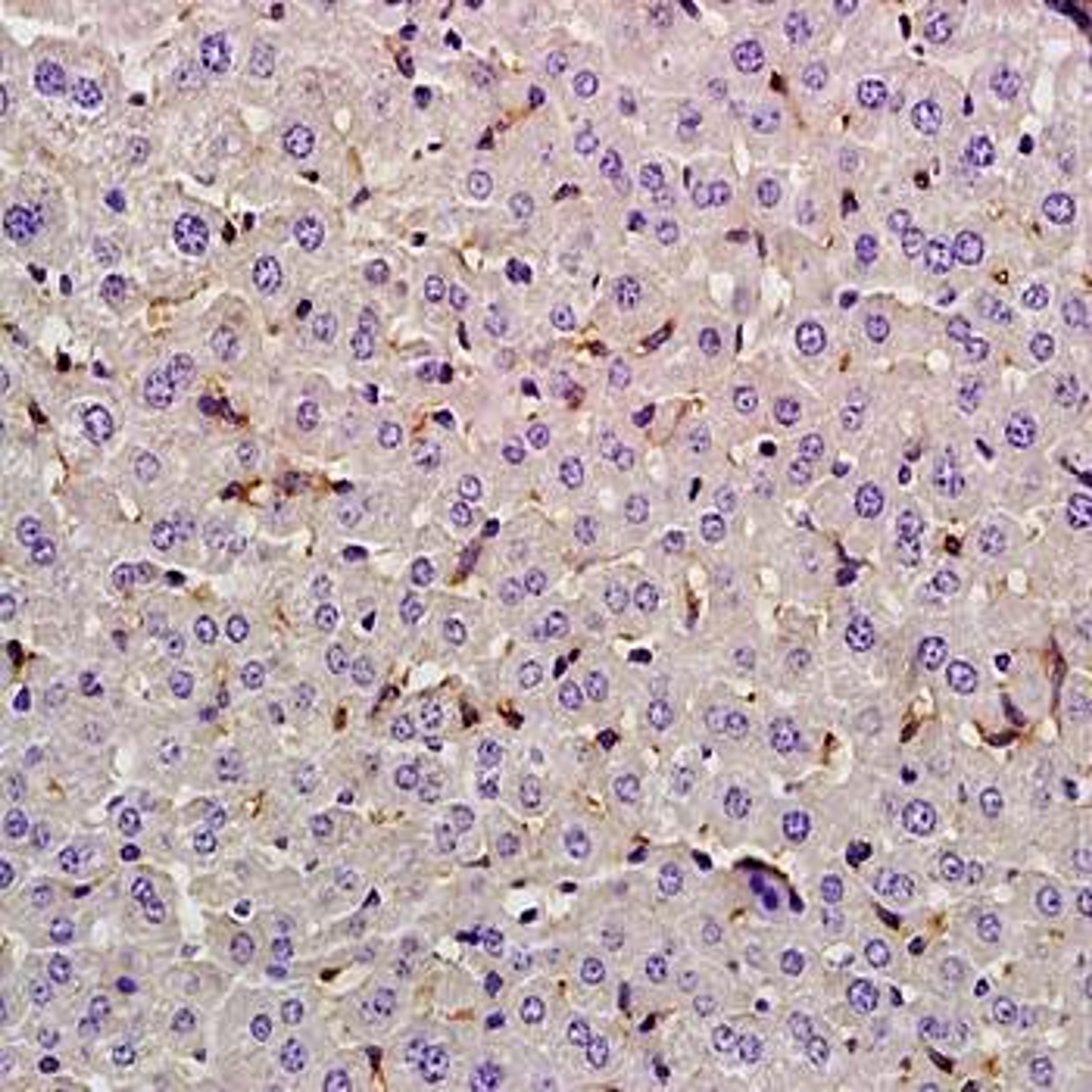 Immunohistochemical analysis of formalin-fixed and paraffin embedded rat liver tissue (dilution at:1:200) using Lysozyme antibody