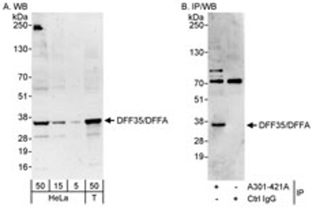 Detection of human DFF35/DFFA by western blot and immunoprecipitation.