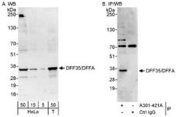 Detection of human DFF35/DFFA by western blot and immunoprecipitation.