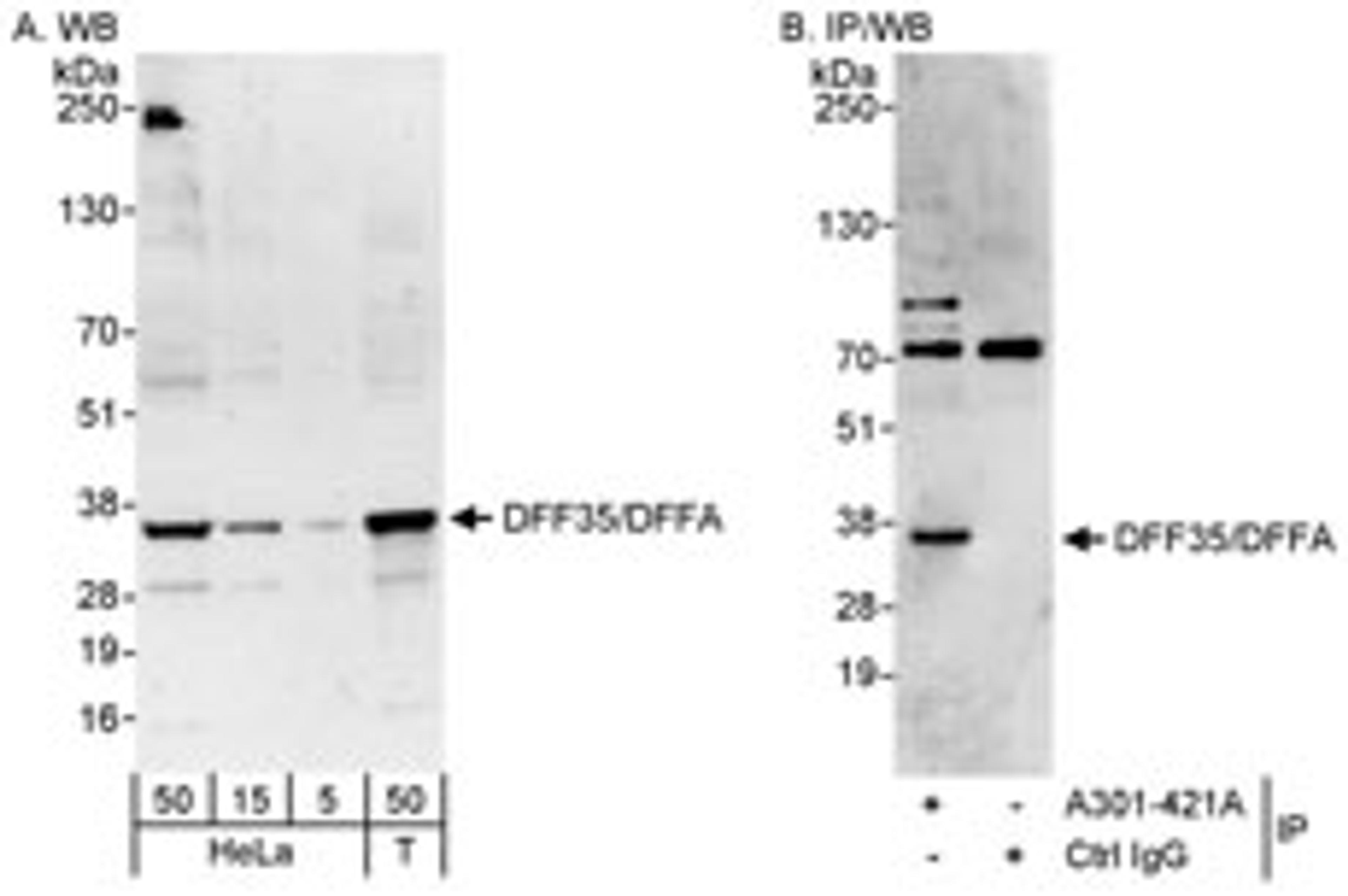 Detection of human DFF35/DFFA by western blot and immunoprecipitation.