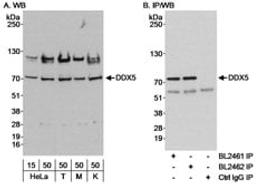 Detection of human DDX5 by western blot and immunoprecipitation.