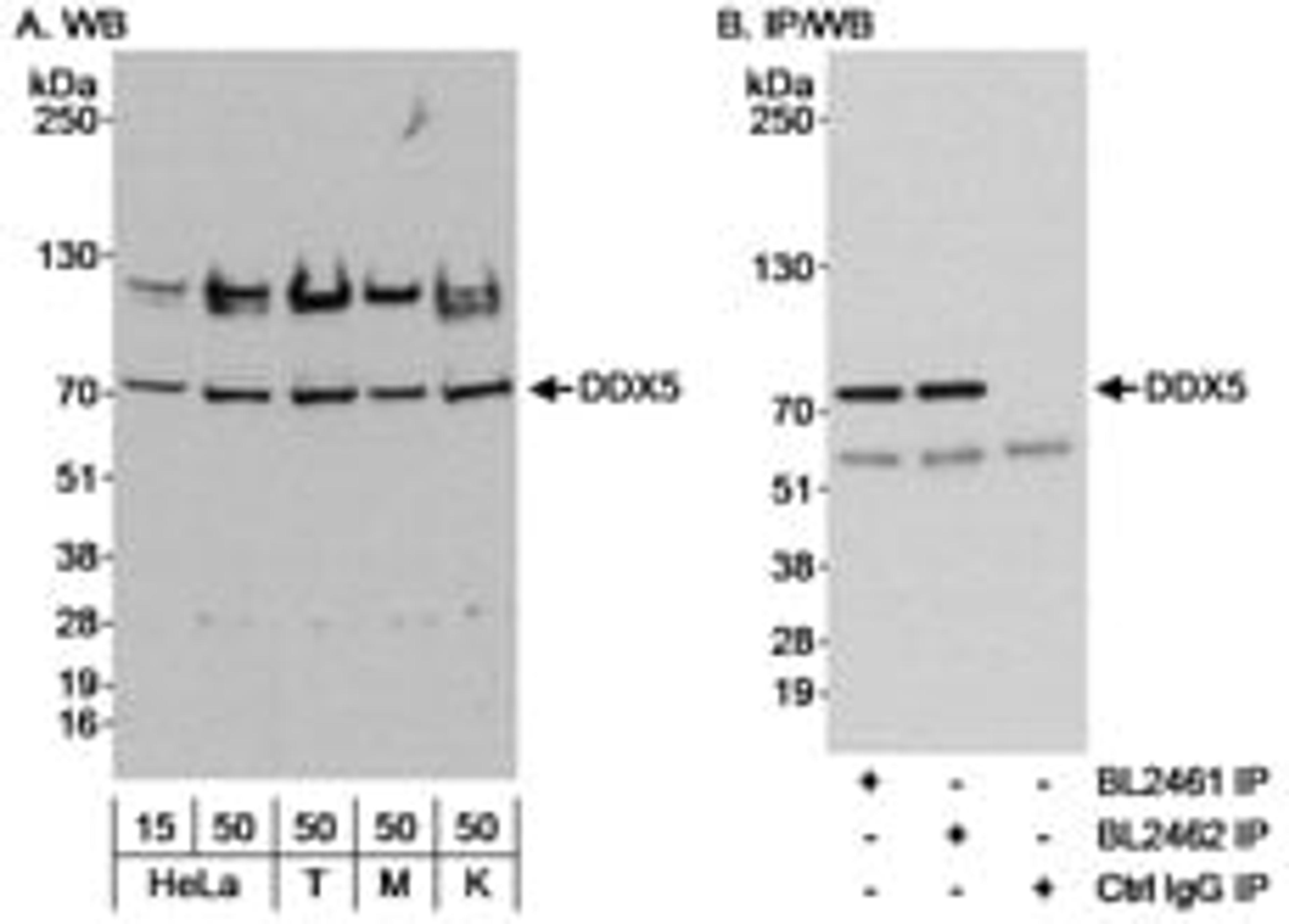 Detection of human DDX5 by western blot and immunoprecipitation.