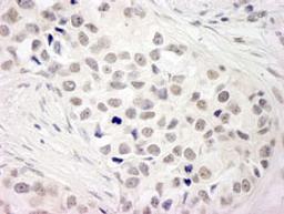 Detection of human NCOA5 (CIA) by immunohistochemistry.