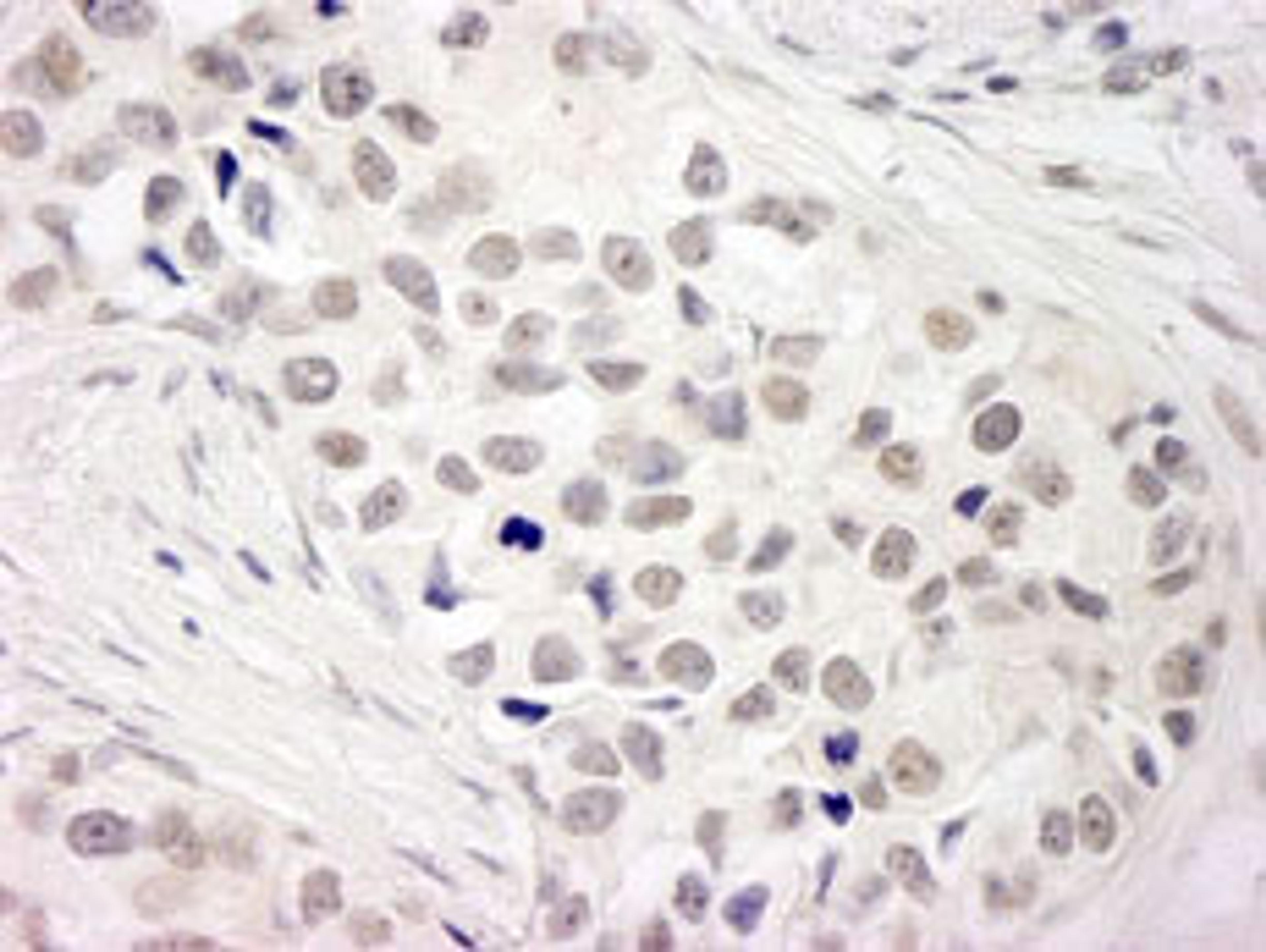 Detection of human NCOA5 (CIA) by immunohistochemistry.