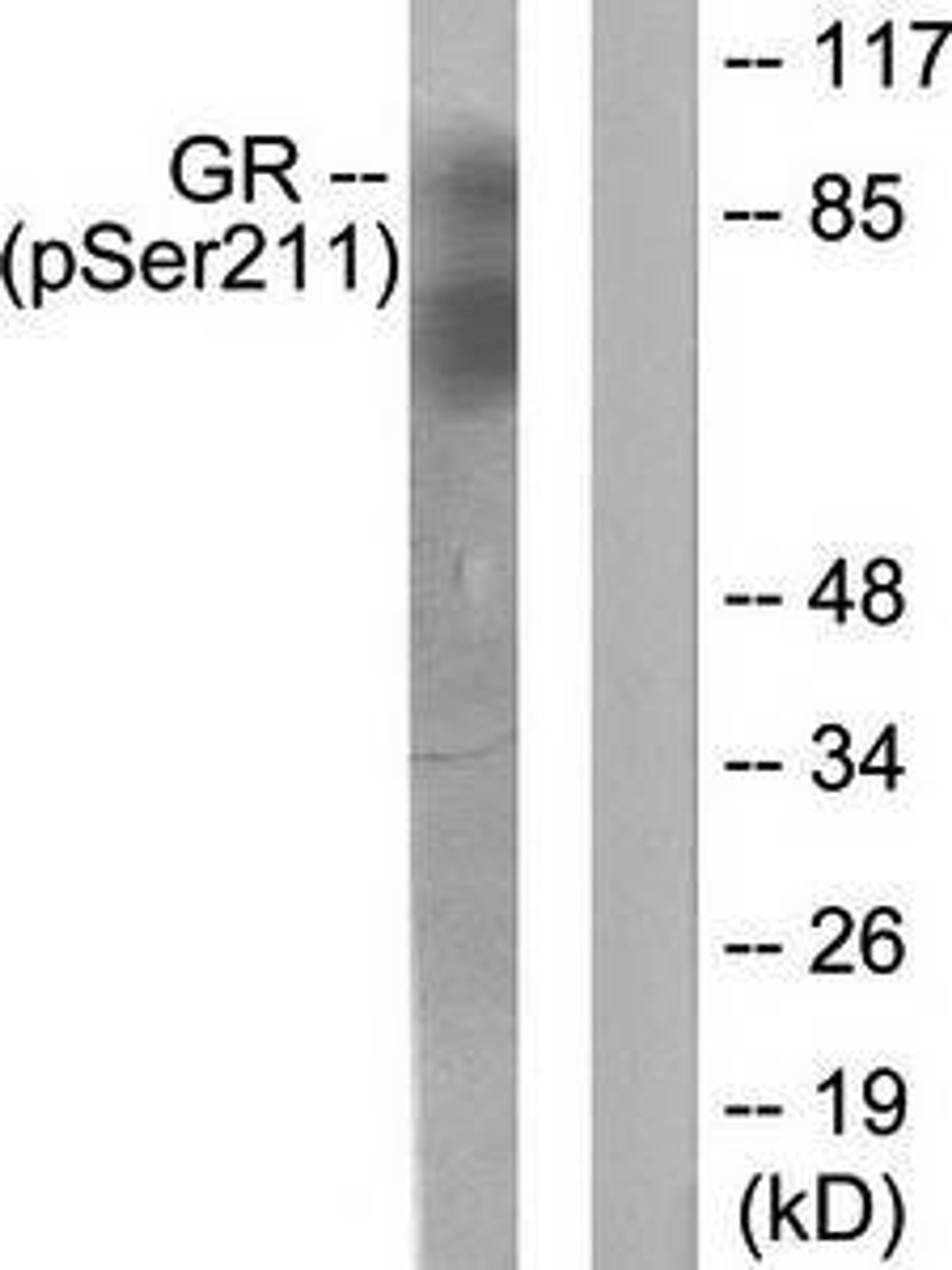 Western blot analysis of extracts from HeLa cells using GR (phospho-Ser211) antibody