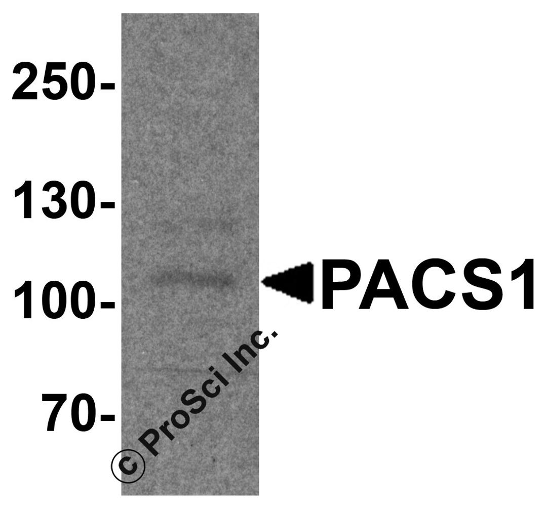 Western blot analysis of PACS1 in rat bladder tissue lysate with PACS1 antibody at 1 μg/ml.