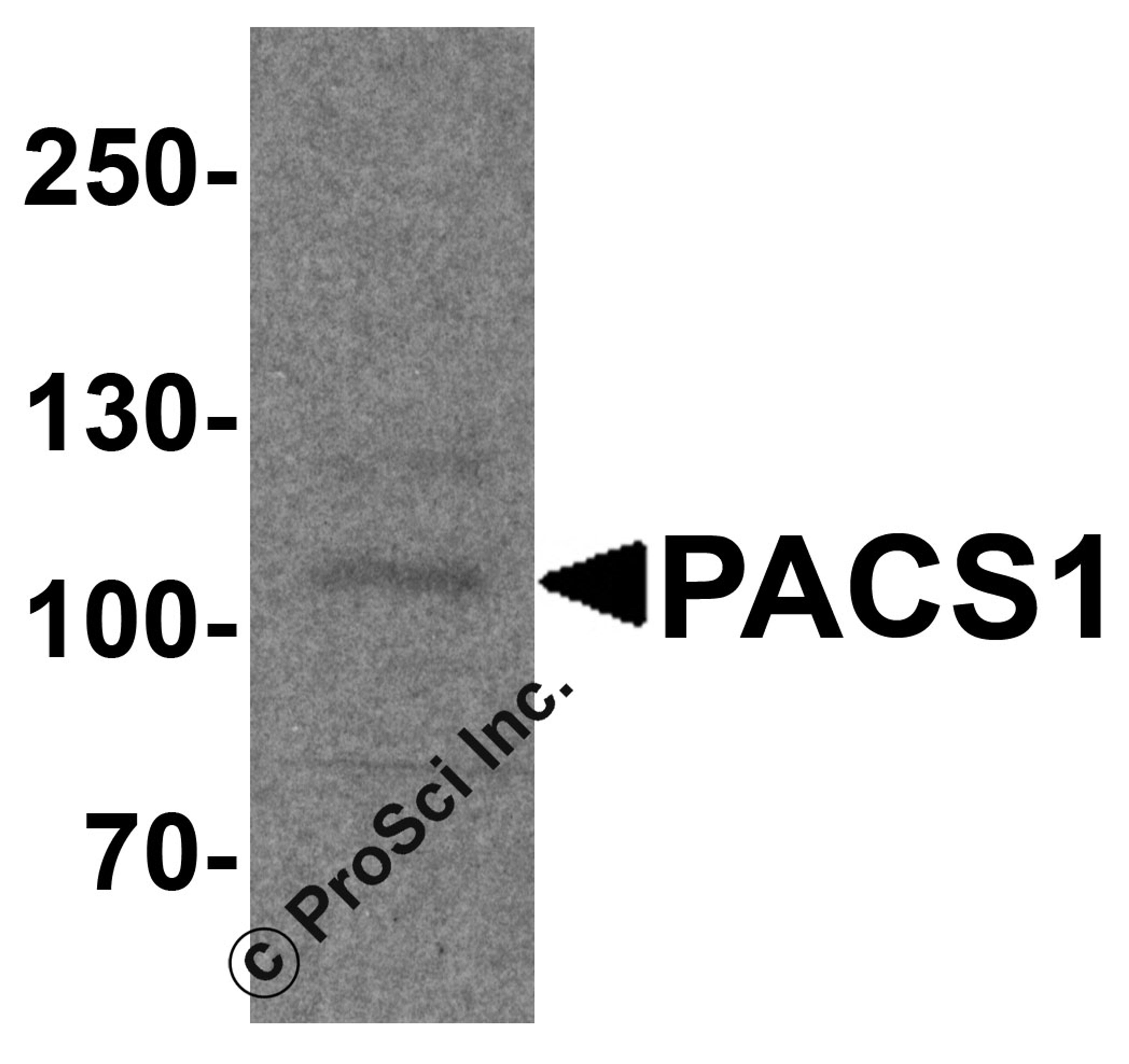 Western blot analysis of PACS1 in rat bladder tissue lysate with PACS1 antibody at 1 μg/ml.