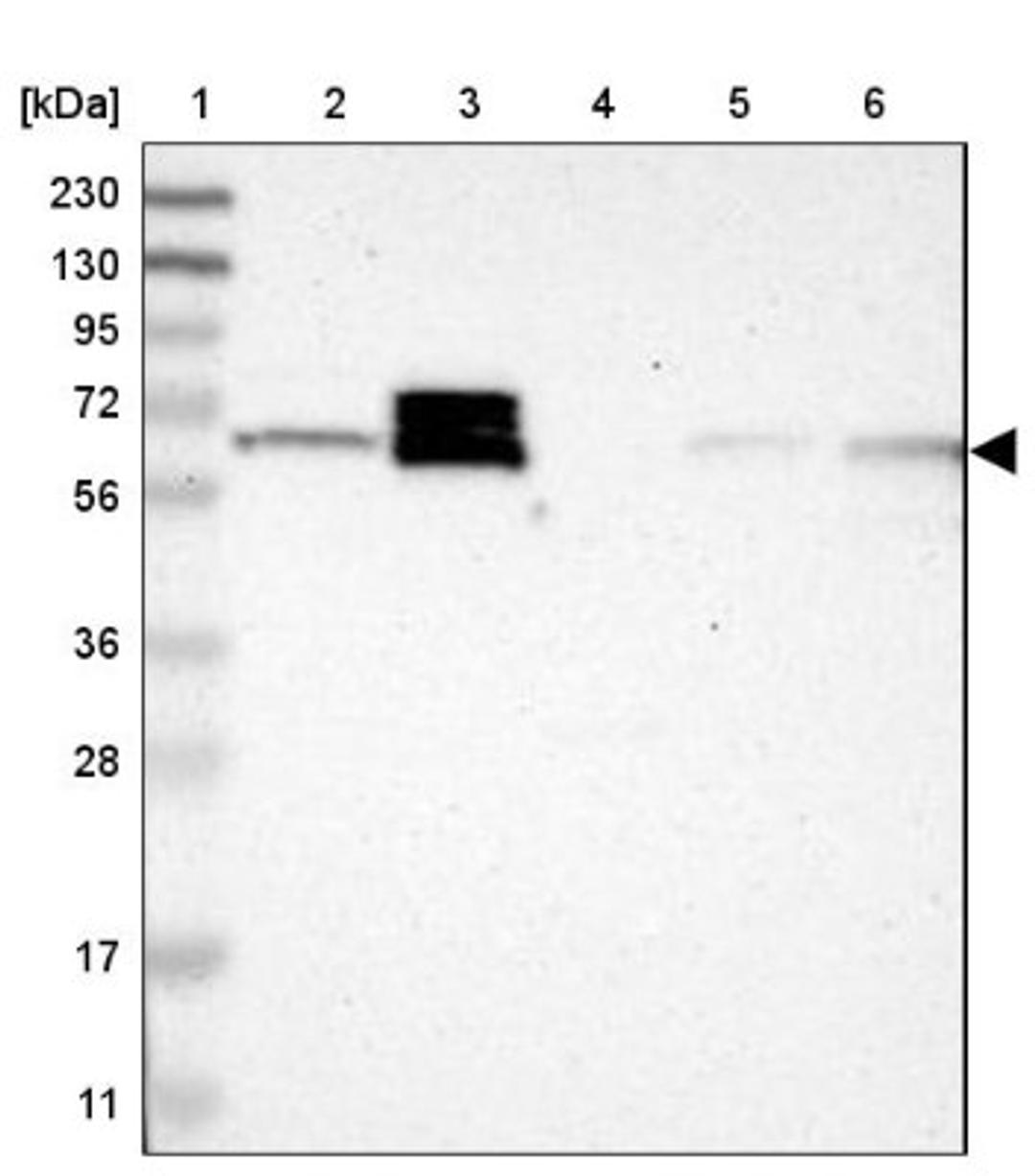 Western Blot: CRMP4 Antibody [NBP1-85447] - Lane 1: Marker [kDa] 230, 130, 95, 72, 56, 36, 28, 17, 11<br/>Lane 2: Human cell line RT-4<br/>Lane 3: Human cell line U-251MG sp<br/>Lane 4: Human plasma (IgG/HSA depleted)<br/>Lane 5: Human liver tissue<br/>Lane 6: Human tonsil tissue